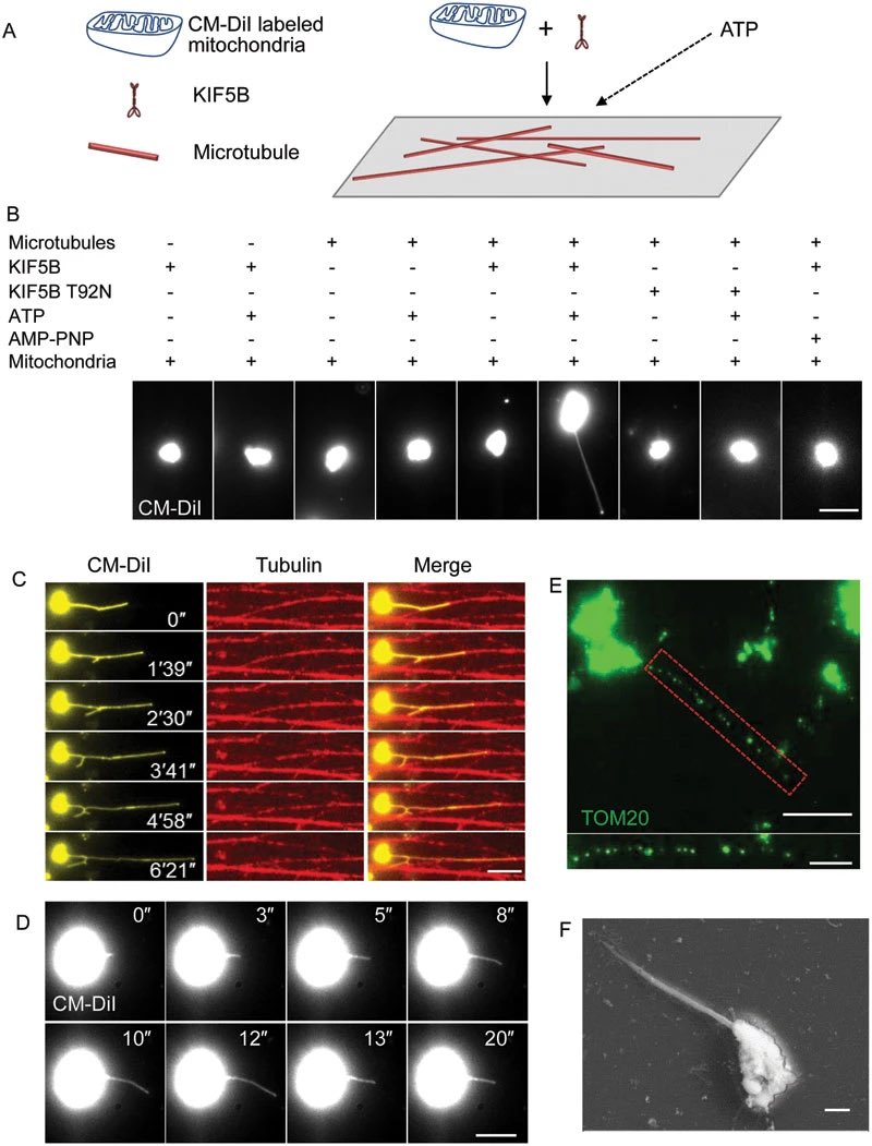 Daniel Lanino (@daniellanino) on Twitter photo Great highlight shared by <a href="/MitoPsychoBio/">Martin Picard</a> showing mitochondrial nanotunnels following microtubule tracks. Here, the microtubule motor kinesin is able to pull nanotubules where the cell desires (energy permitting)
So many fascinating interactions between these organelle systems Great highlight shared by <a href="/MitoPsychoBio/">Martin Picard</a> showing mitochondrial nanotunnels following microtubule tracks. Here, the microtubule motor kinesin is able to pull nanotubules where the cell desires (energy permitting)
So many fascinating interactions between these organelle systems