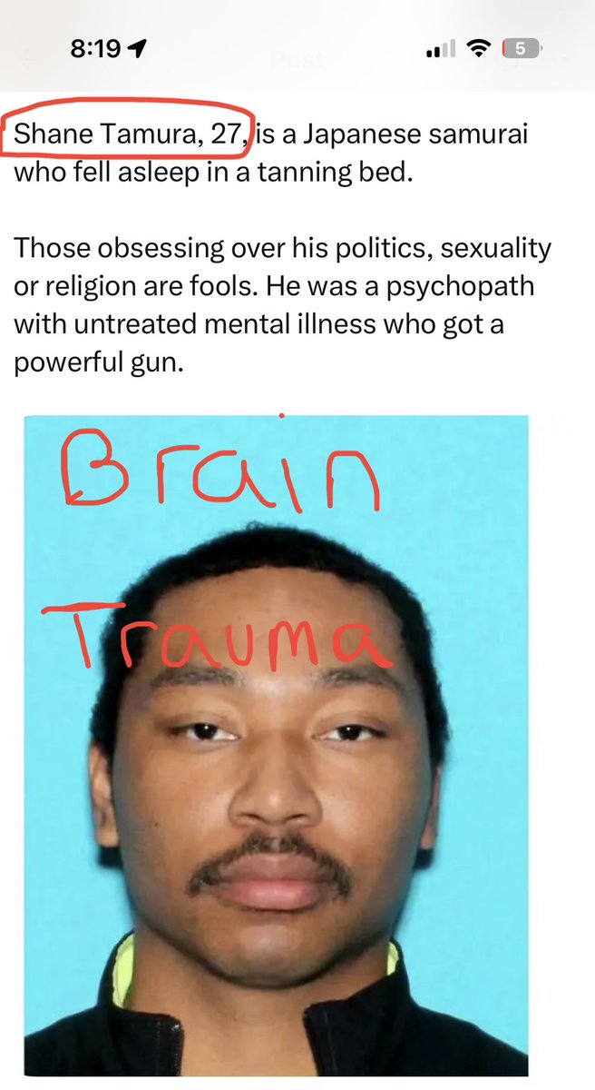 Shane Tamura / Brain Trauma suffered from CTE