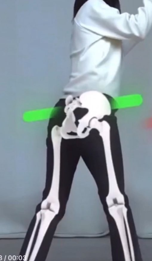 ALL FLAWS &amp; LOW LEVEL MOVEMENTS OF HITTERS: Coiling the pelvis posteriorly, counter rotation of the shoulders. Swaying back &amp; then forward. Spinning transversely on your back leg with a level pelvis.