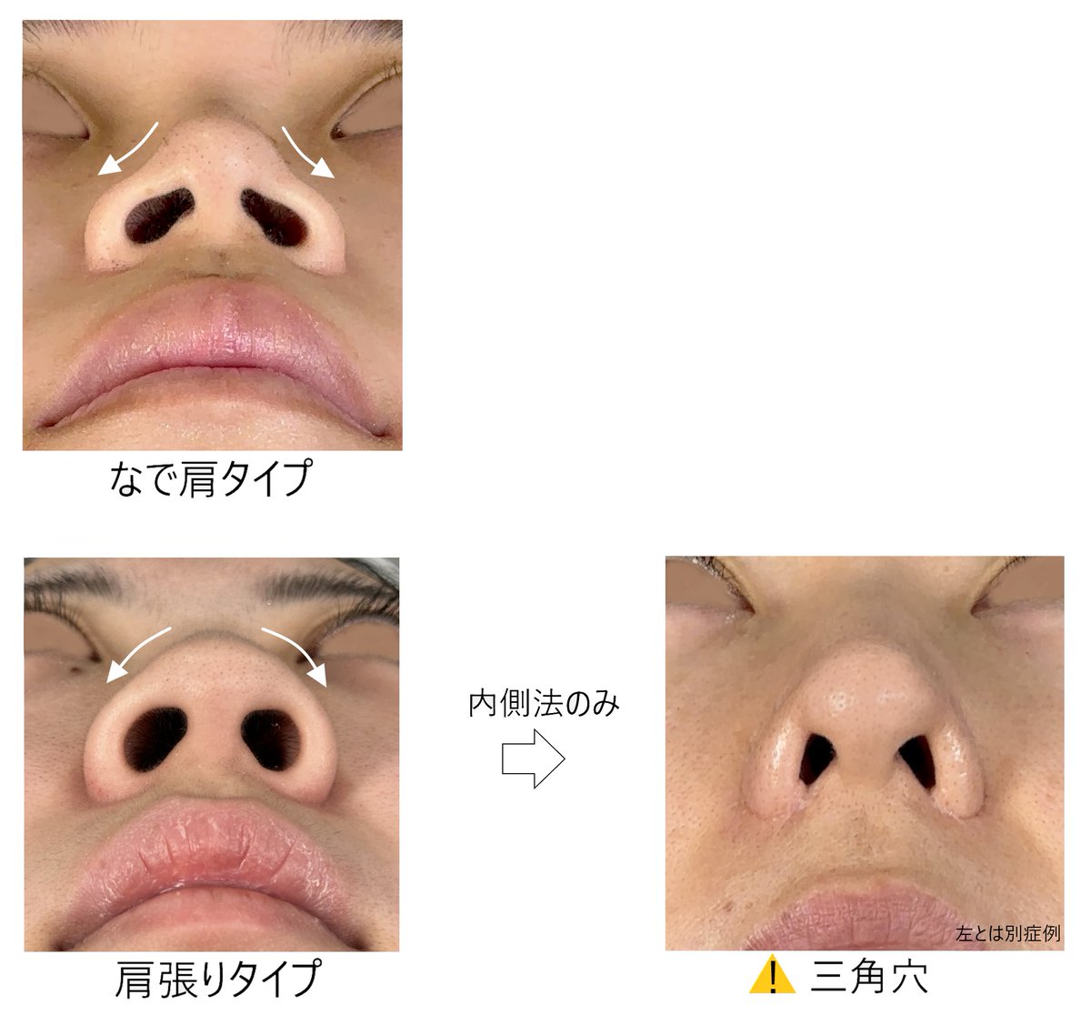 理想の鼻を作るノーズシャドウ完全ガイド | 2025 年のリアルなLemon8ユーザー体験, image size:1200x1116