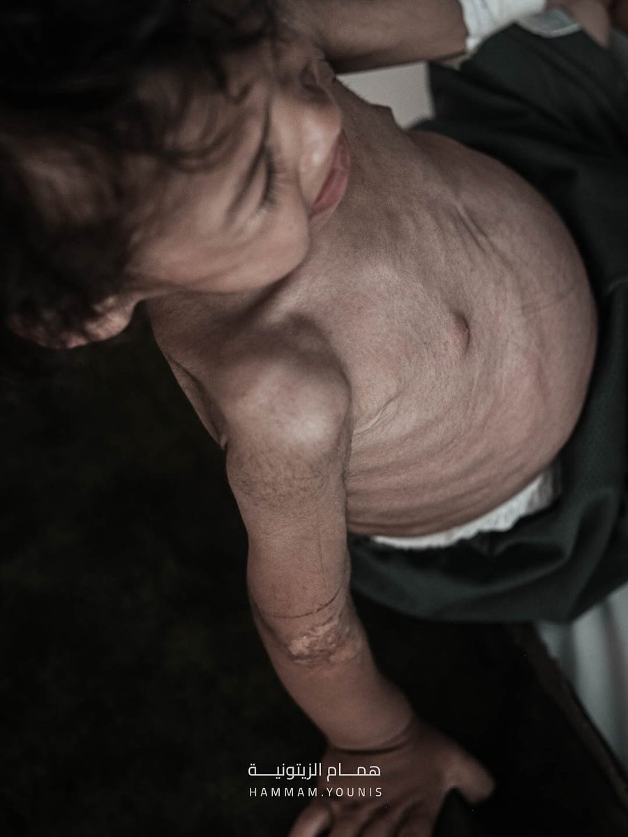 Our children are starving. #Gaza