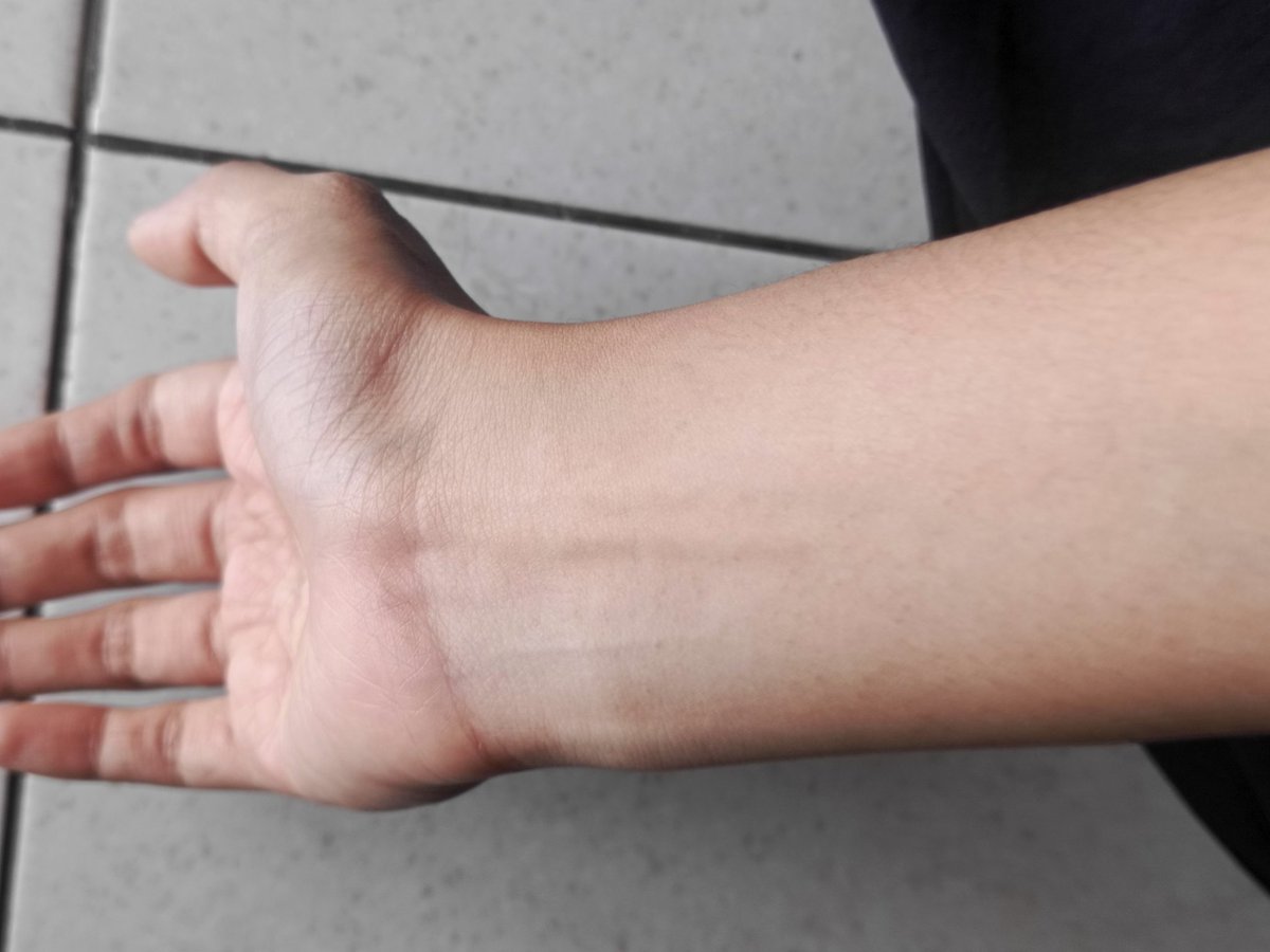 Ithinksoo0's tweet photo. guys aku tu bingung banget undertone aku apa, kalo aku liat si cenderung ke ungu tapi ada hijaunya. 

mohon infonyaa 😭🙏🏻 https://t.co/UGmVhk49Zf