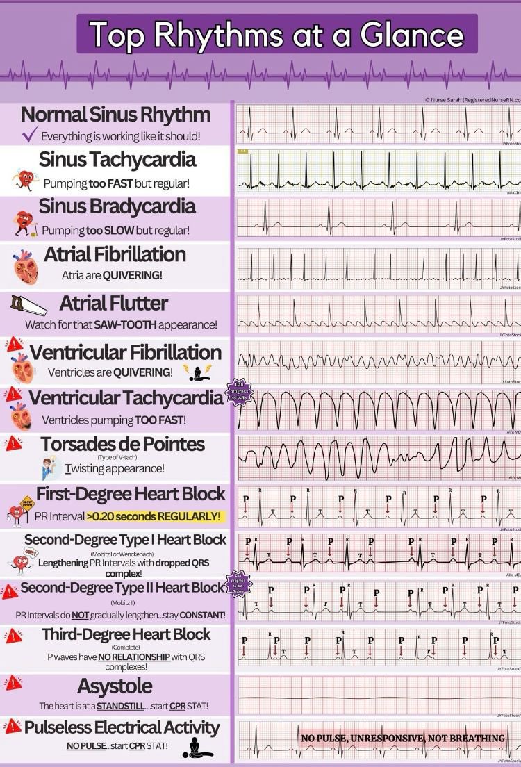 Last Minute Revision ECG all in one ☝🏻

#NEETPG #NEETPG2025 #MedTwitter