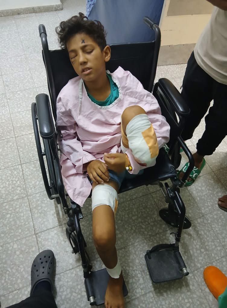 🚨BREAKING: 13 year old Rakan is the sole survivor of an Israeli airstrike that killed his entire family in Gaza. He suffered multiple fractures, a leg amputation, and severe injuries to both eyes.

He urgently needs major surgery to repair his retina and stop internal bleeding
