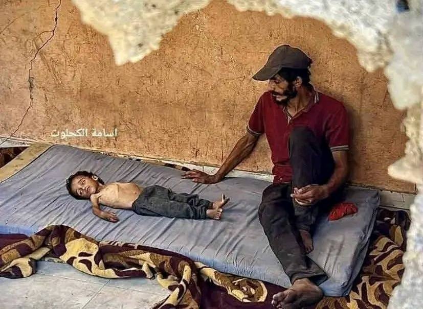 Once again, Hamas is using photos of sick children to push the “starvation” narrative and blame Israel.
But the truth tells a different story.

#TheFacts: 14-year-old Abdul Qader al-Fayoumi was treated in Israel back in 2018 for a genetic disease.

Abdul was one of the hundreds