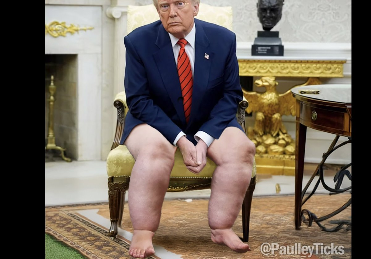 anyidea's tweet image. Is Trump going to be in a wheelchair soon?#youtubeshorts #shorts #celebr... youtube.com/shorts/w_CBXbg… via @YouTube #ชายแดนไทยกัมพูชา #BlockBusterKINGDOM #StrayKids_dominATE_Rome