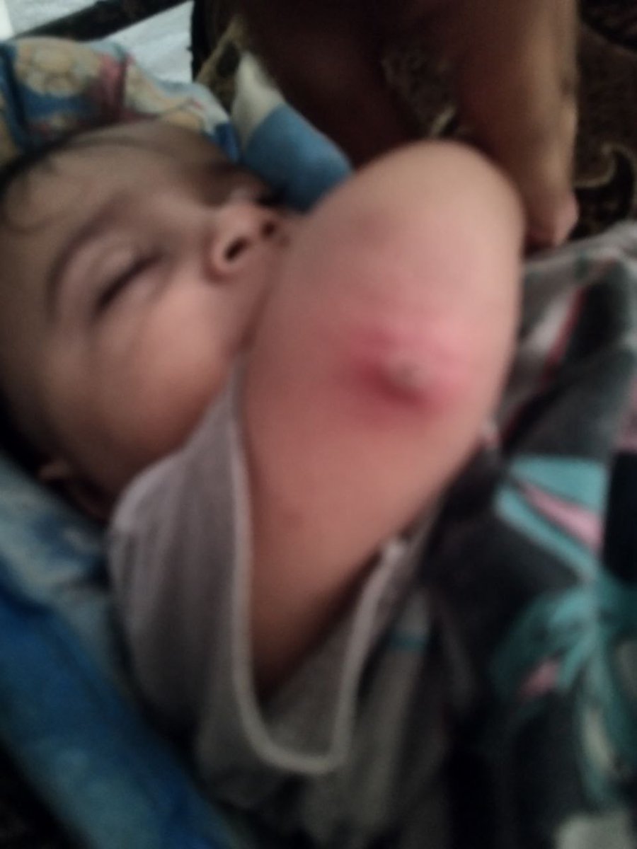 Baby Agalia completely depends on our donations to buy diapers and baby formula.

Dxnate: chuffed.org/project/135074…

Also follow her account &amp; interact with her. <a href="/AgaliaAdnan/">اجاليا عدنان</a>
