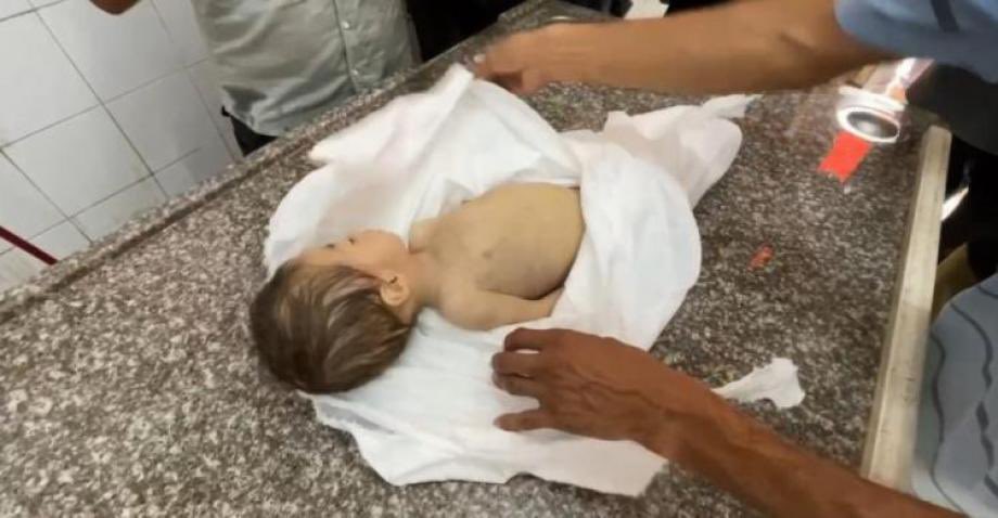 In Gaza, not an hour passes without the announcement of the death of a child due to hunger.
Children's souls are taken in silence — not by bullets, but by empty stomachs and bodies exhausted by the siege.
Their features wither, and their ribs become visible, until their small
