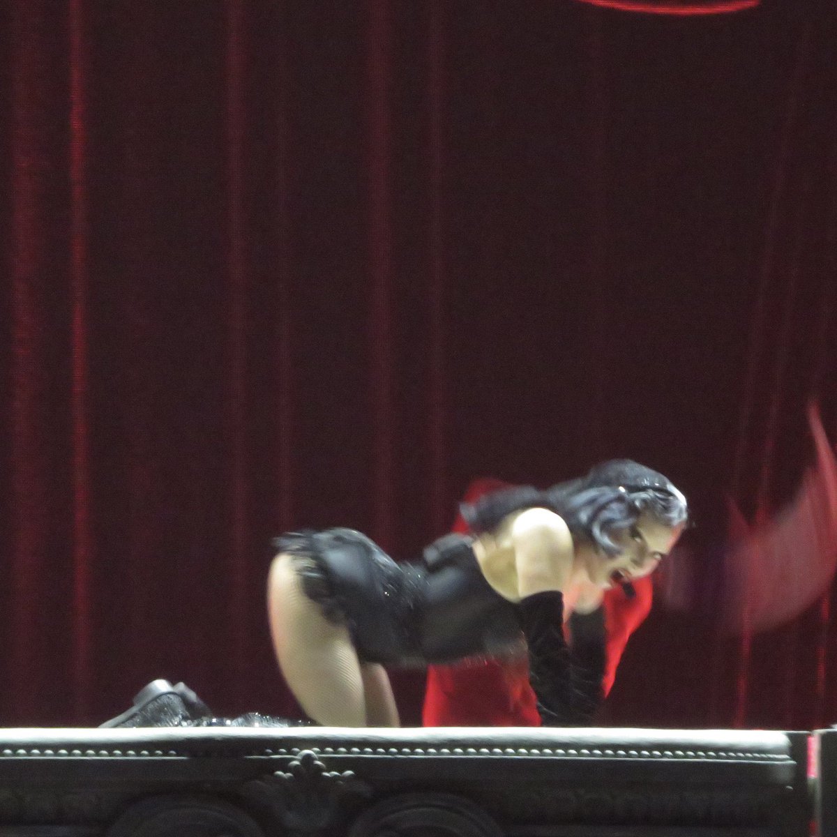 O quadril de titânio da Lady Gaga.