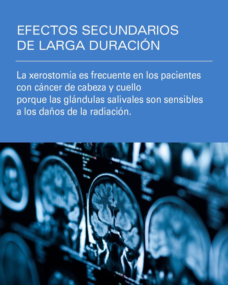 Efectos secundarios de larga duración: Xerostomía​

Sequedad bucal frecuente tras radioterapia en tumores de cabeza y cuello.​

Puede alterar el gusto y dificultar tragar, dormir o hablar.​

#Xerostomía #MDAndersonCancerCenterMadridHospiten