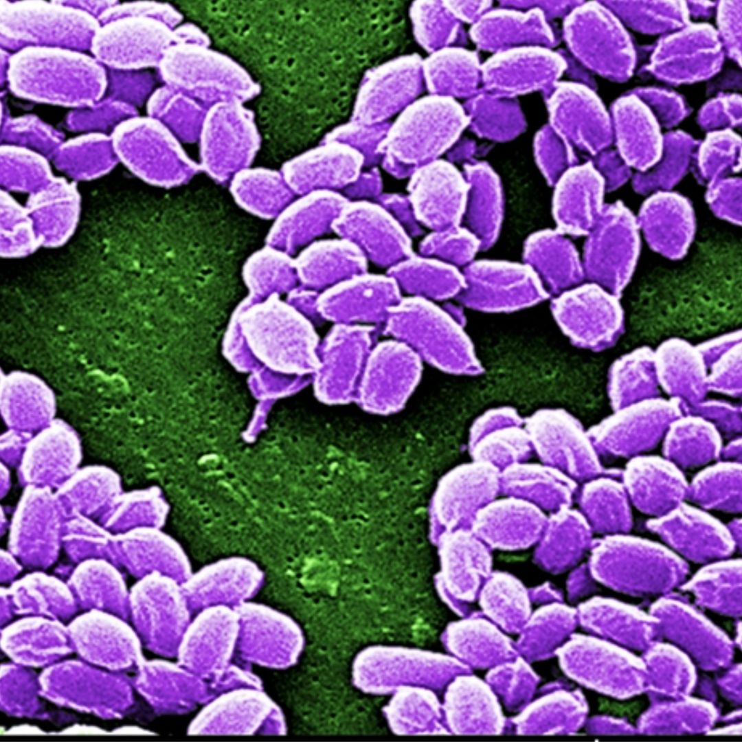 Anthrax may seem like a disease of the past, but changing climate could bring old outbreaks back.

Researchers in 🇦🇹 found decades-old spores still alive in the soil.

Find out how to identify and manage hidden risks. ⬇️
environment.ec.europa.eu/news/historic-…

#SfEP