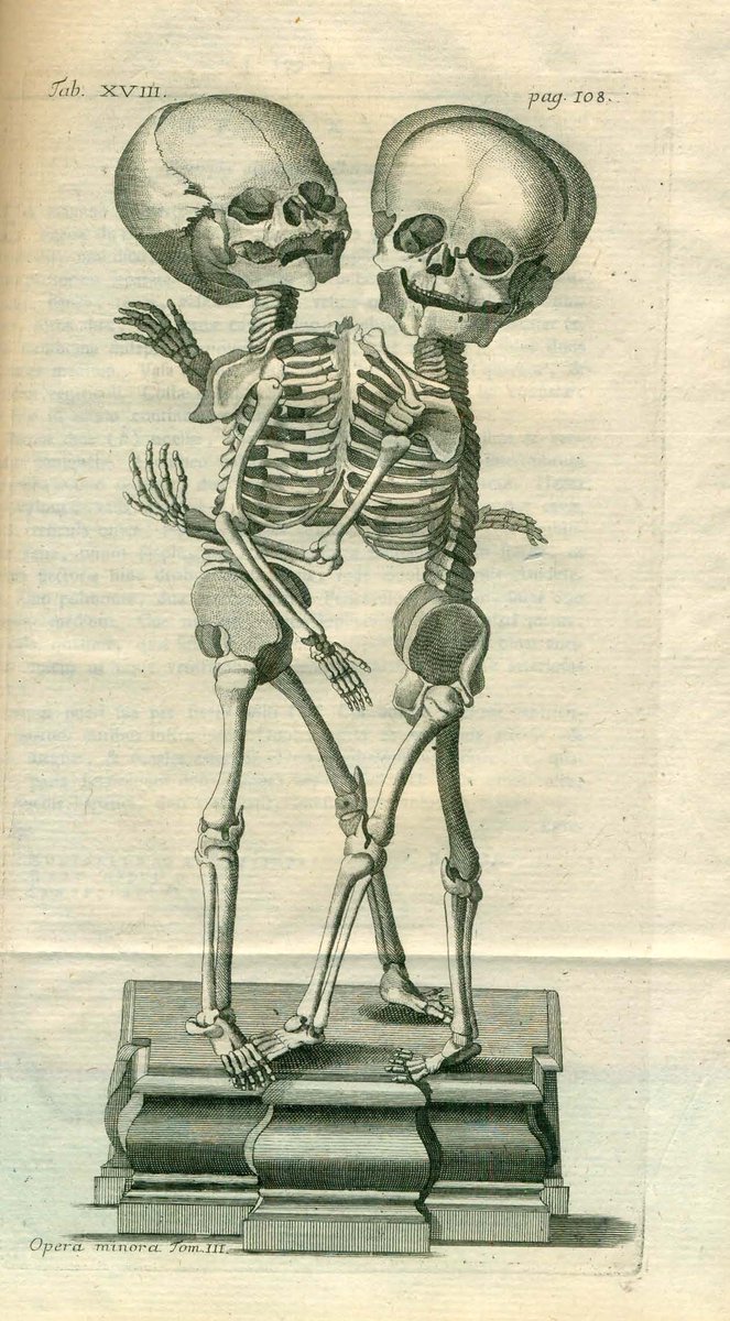 BibyArchRANME's tweet image. En los trabajos anatómicos de Albrecht von Haller (1708-1777), publicados en #Lausana (1768), se recoge esta ilustración de dos siameses unidos por el #tórax #HistMed #Anatomia #SigloXVIII  #libroantiguo @ranm_es  bibliotecavirtual.ranm.es/ranm/es/consul…