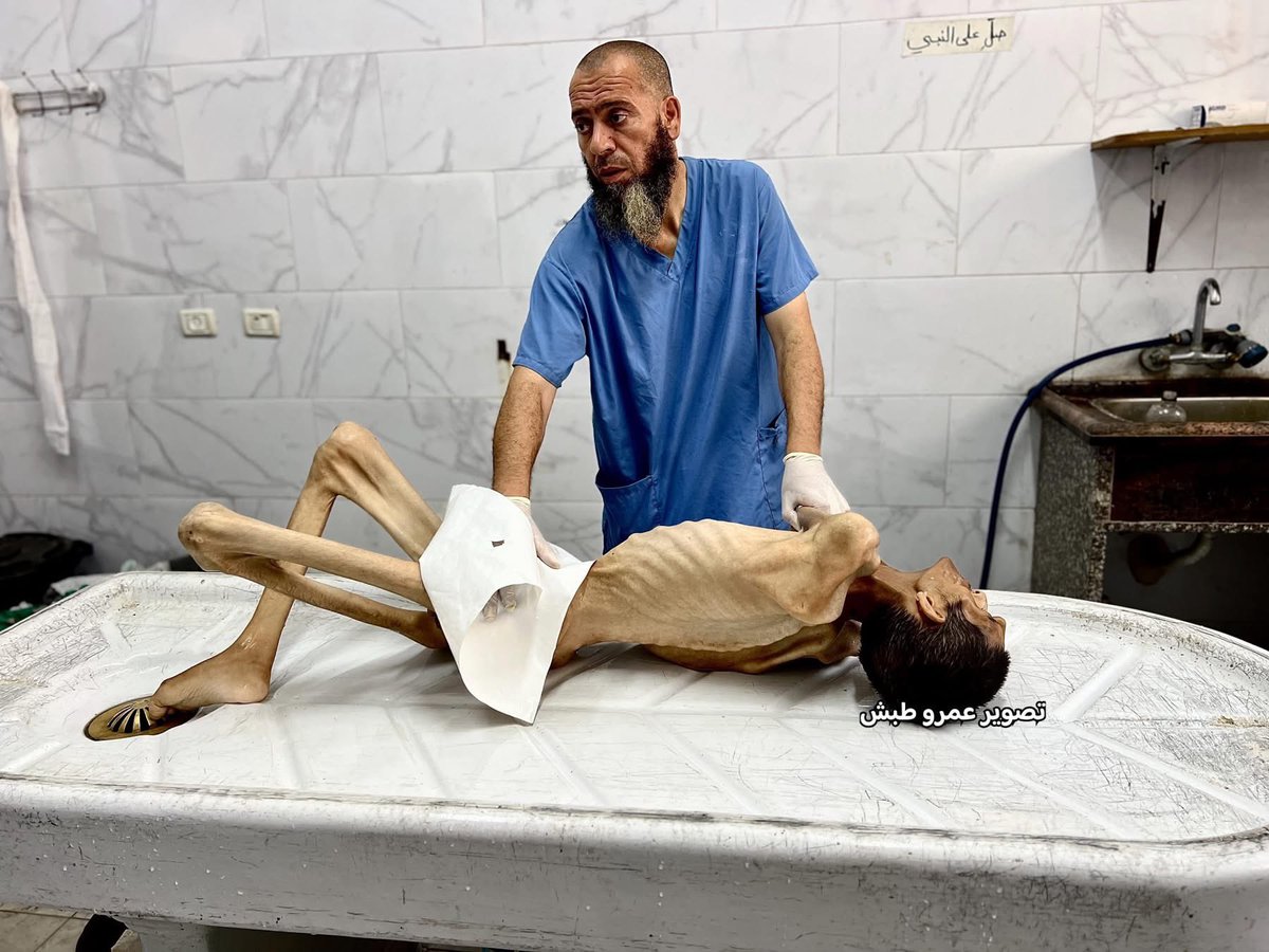 استشهاد الشاب عادل ماضي (27 عامًا) في مجمع ناصر الطبي بخانيونس، نتيجة التجويع وسوء التغذية الحاد، ونقص الأدوية والعلاجات الأساسية، بعدما فتك به الجوع وأنهكه المرض في ظل انعدام أبسط مقومات الحياة.
#GazaGenocide‌ 
#GazaStarving