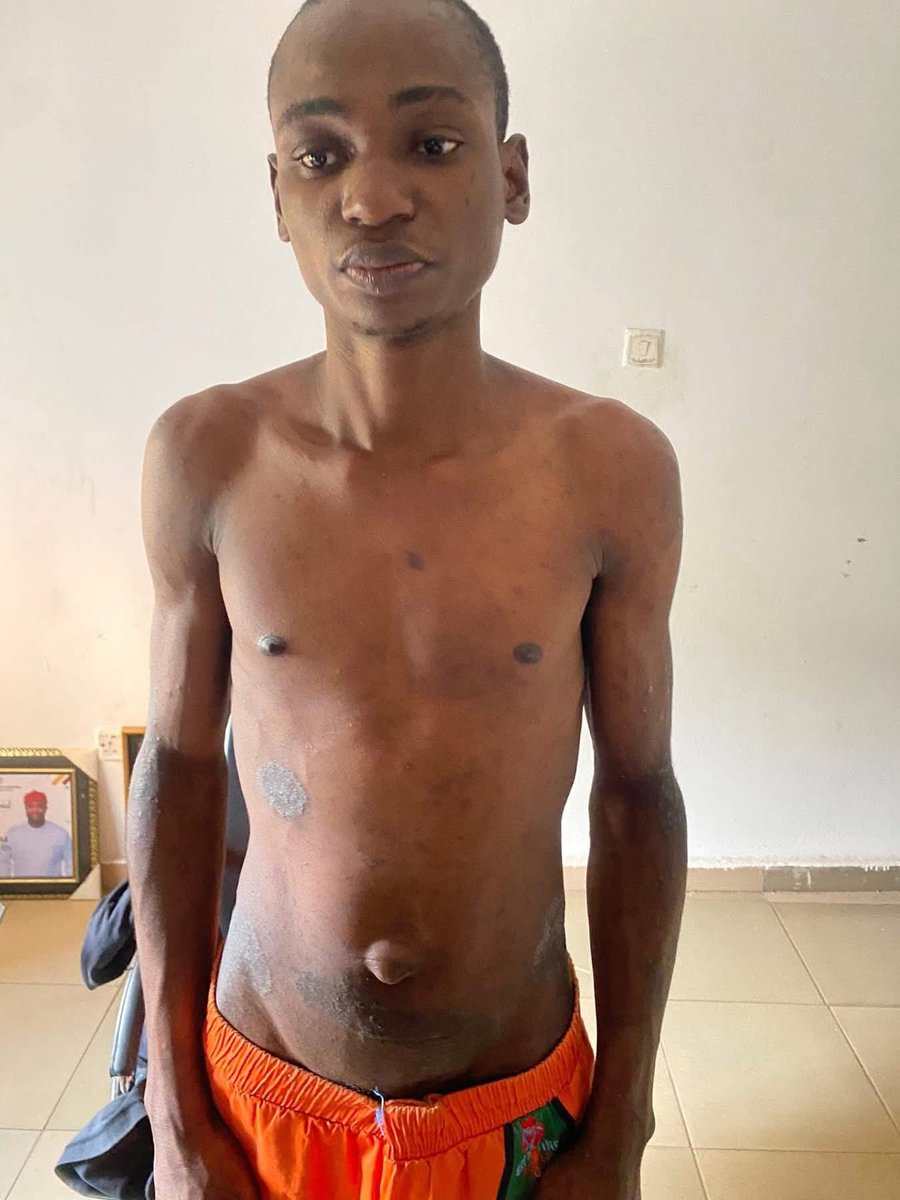 MostMerit's tweet image. Gist:  Emeka Nzeruike has been released from prison after he was allegedly accused of st£aling. He was sent to pr!son when we was 12 in 2015.  He has been in pr!şon for 10 years  💔 💔 😢
Welcome back boy,but his lost years ,how will he bring it back?