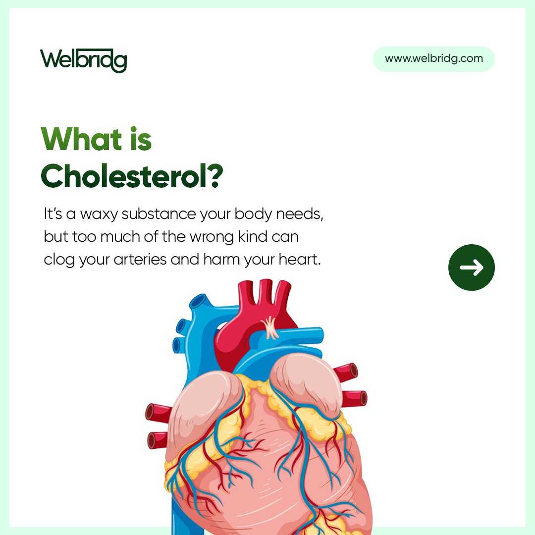 welbridg's tweet photo. Not all foods love your heart. 
Let’s talk about what increases cholesterol and what to avoid.

Your body (and future self) will thank you.

 #HeartHealth #EatSmart #HealthyChoices #Welbridg #WelbridgCares #WellnessTips https://t.co/WVyAnRCalK