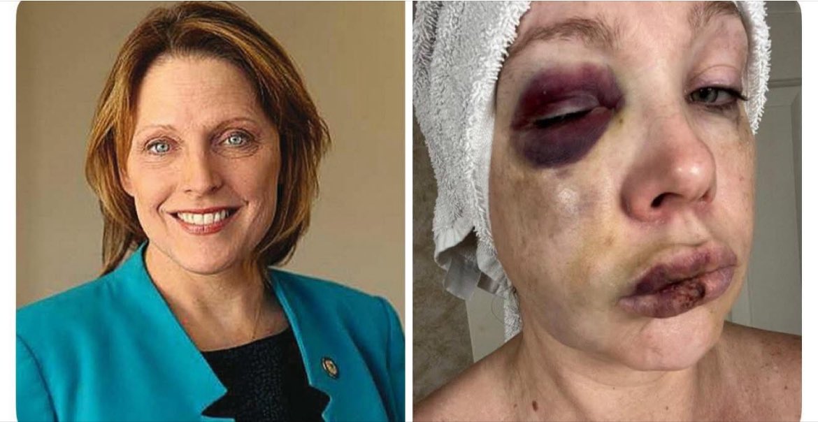 This is Hamilton Country Prosecutor Connie Pillich who allowed one of the black suspects involved in the beating of white people at a Cincinnati Jazz Fest to be released on $400 bail. This is one of the white victims Holly who was beaten.  
This isn’t that far from
Where I live.