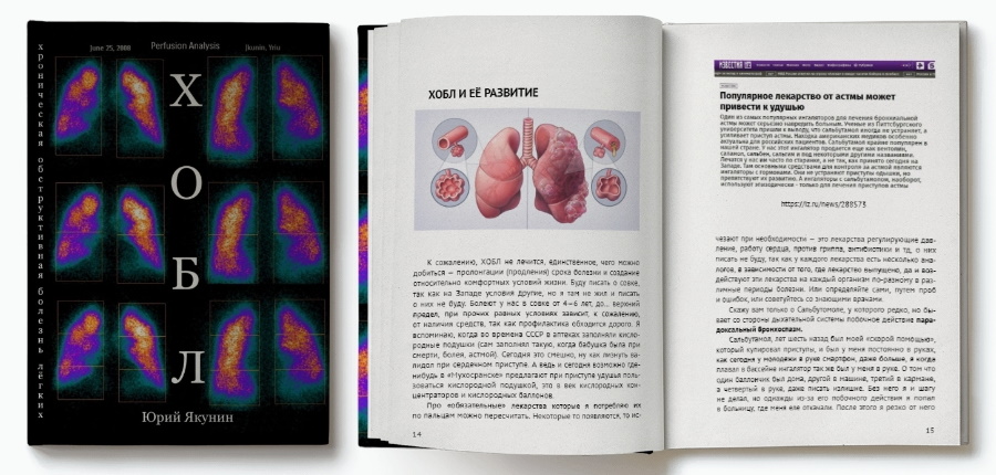 Закончил книгу о своей проклятущей болезни - "ХОБЛ"
Закончил книгу "ХОБЛ". Это книга о том как я болею ХОБЛ уже 25 лет.
В отличие от других моих книг в тексте этой фотографии и картинки. Жаль что все предыдущие книги были без фотографий. 
Дальше: - yurayakunin.livejournal.com/15383367.html