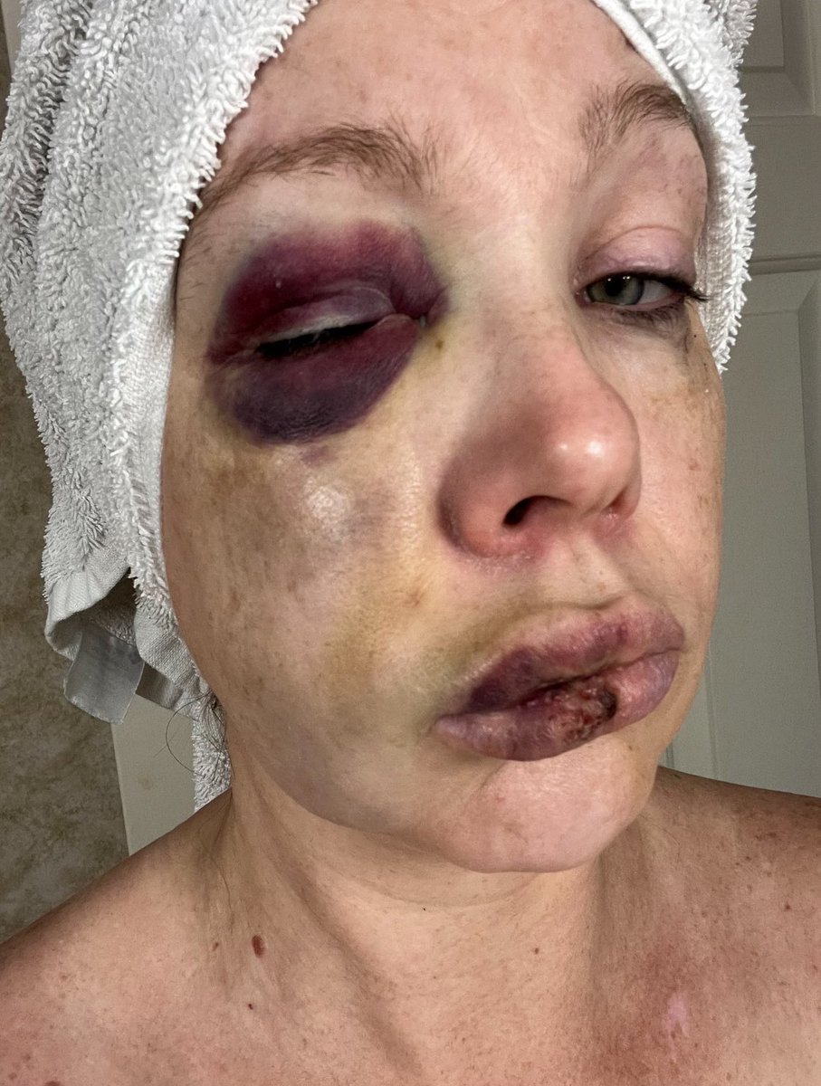 This was a Hate Crime, so where are the Hate Crime charges?