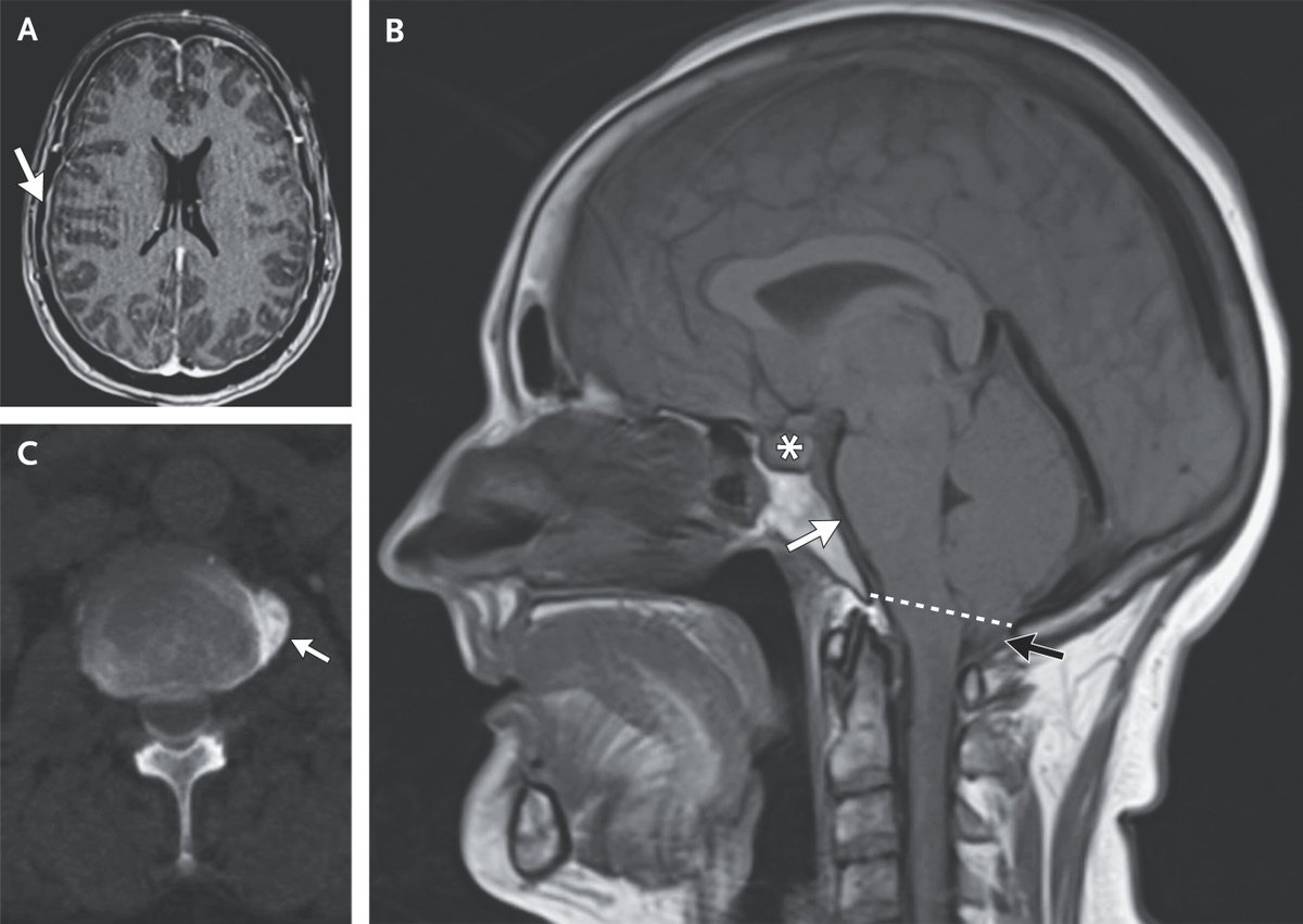 SCCM Neuroscience Section tweet media
