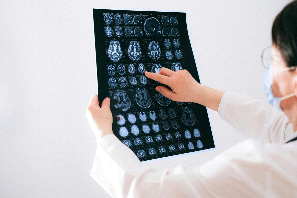 The invisible toll of #TraumaticBrainInjury (TBI):
From brief disorientation to long-term unresponsiveness—altered consciousness is serious.

Know the signs &amp; what to do: bit.ly/3GCoDkA

#braininjury #personalinjury #caraccident #hullandzimmerman #northdenverlawyers