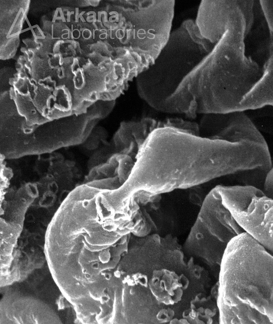 Today's #eyeSCANdy is a SEM of acellular GBMs from segmental membranous illustrating the variability of size and shape of the GBM formations. 

Photo courtesy of Dr. Stephen Bonsib. #renal #pathology #kidneypath
