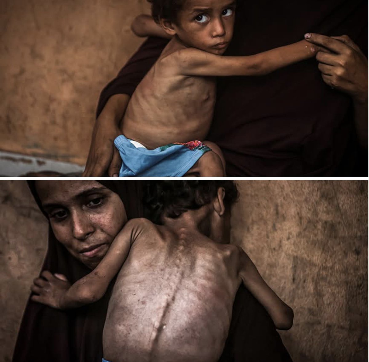 Gazze’de henüz 3 aylık olan Yahya bebek açlıktan hayatını kaybetti.
Anne Nida Neccar;
“Bebeğim günlerce sadece su ve anasonla beslendi.Mama bulamadık.Gözlerimin önünde her geçen gün eridi.Sabahtan beri bir şey yememişti.
Ne diyeyim,Allah bana yeter, O ne güzel vekildir.” demiş😔