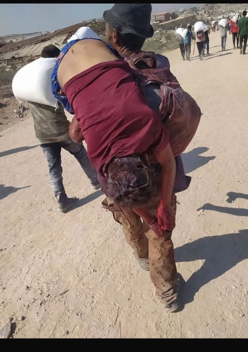 في غزّة…
تُحملُ الجثثُ على الأكتاف كما تُحملُ أكياسُ الدقيق،
لا كفنَ يُلفّها… ولا وداعَ يُرافقها،
تمضي كما جاء الجوعُ…
صامتةً، مهملةً، منسيةً،
إلا في عيون الأمهات.

هذا ليس خيالًا..
هذه غزة 
الموت هناك
أرخص من رغيف الخبز…