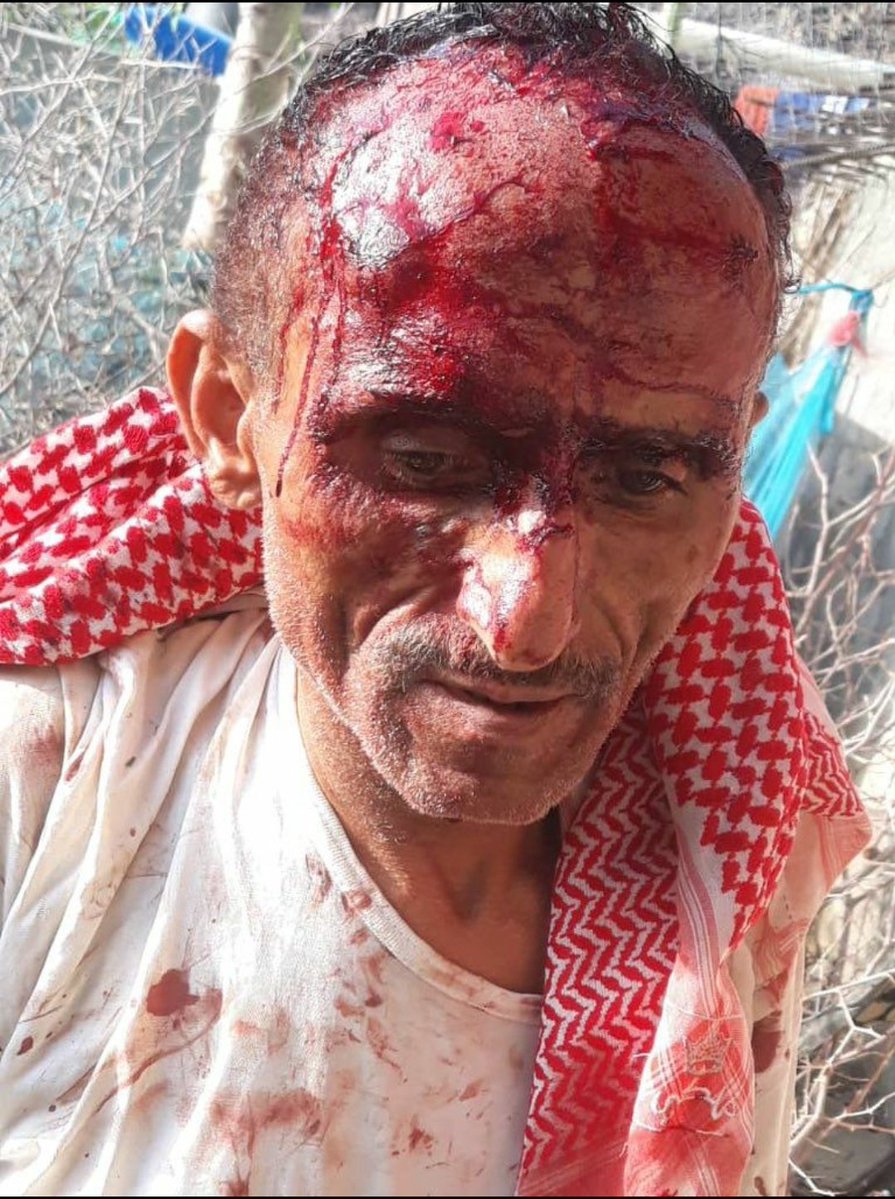 الحوثيون في محافظة إب يهشمون رأس طبيب يمني اعزل أمام أسرته .

وليس بغريب إجرام هذا الجماعة الغريب فعلا هو صمت القبائل اليمنية التي اعلنت النكف على حبس مجرم في محافظة المهرة. 

اليس الأولى ان يكون النكف القبلي على انتهاك الأعراض الذي يقوم به الحوثي في إب  وفي الجوف

وين القبائل ؟