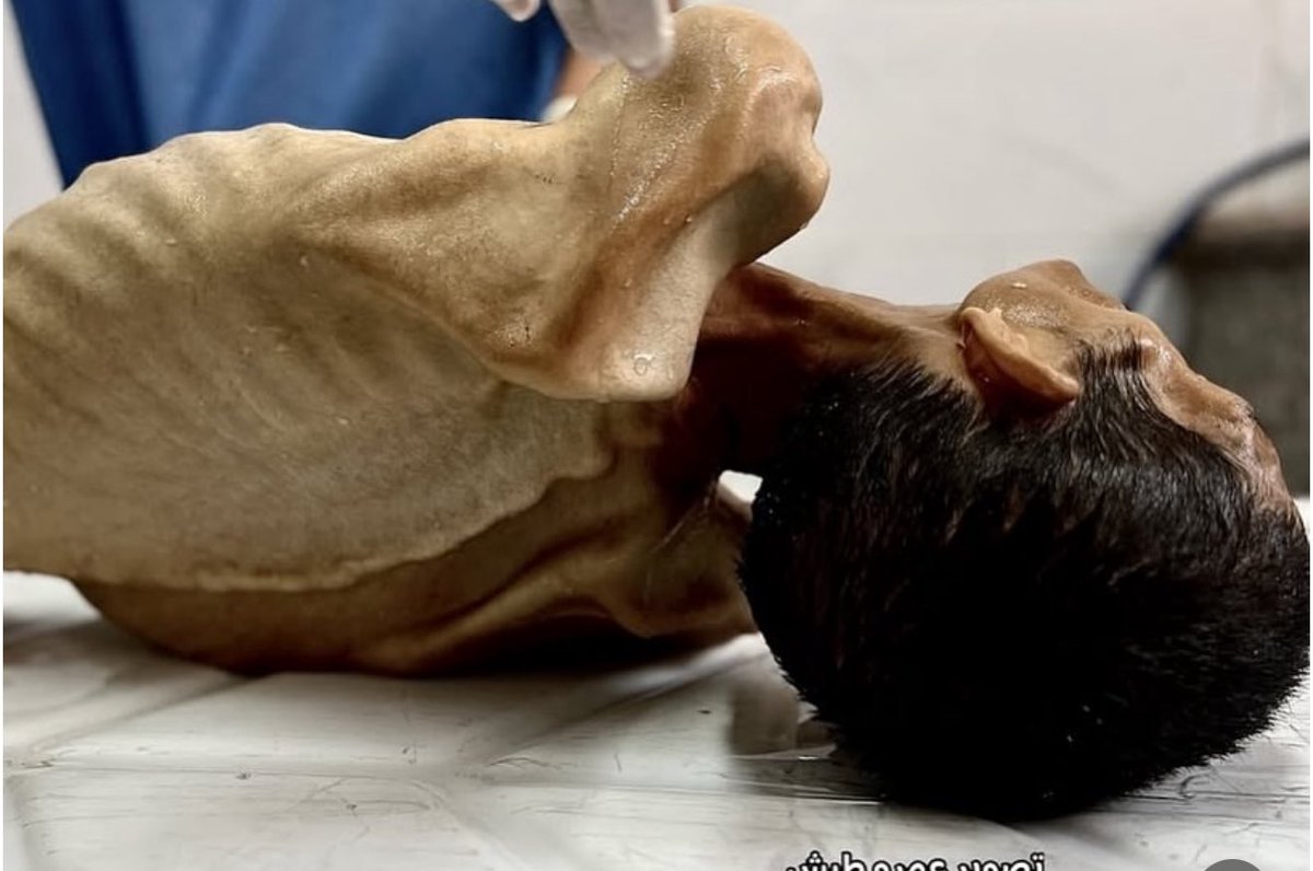 Mosab Abu Toha tweet media