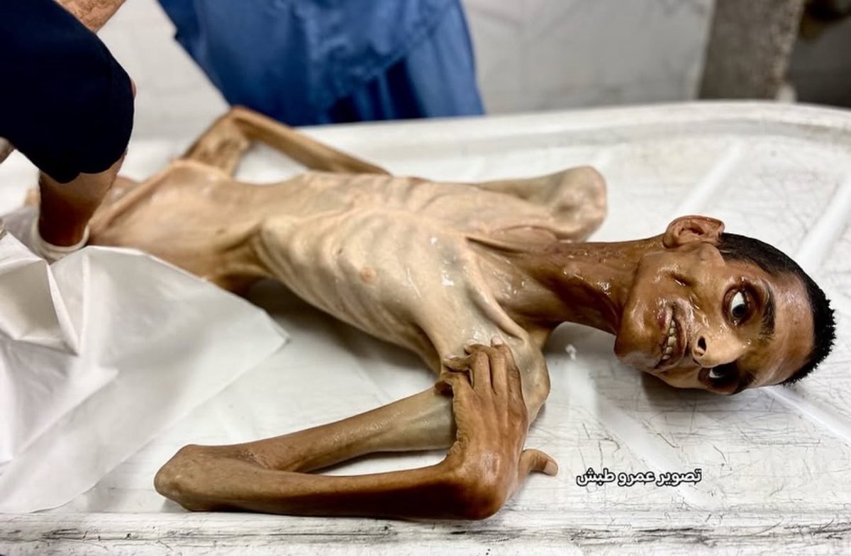 Mosab Abu Toha tweet media