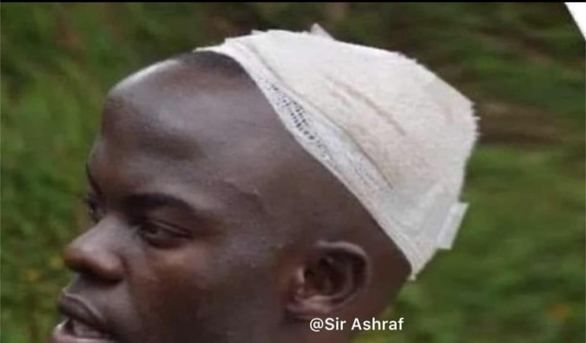 kirya_ug's tweet photo. Today marks 4 years ever since Ugandan celebrity Chris Evans was hit 68 times on the head with a sugarcane and he called it a hammer. https://t.co/oF841A6XAl