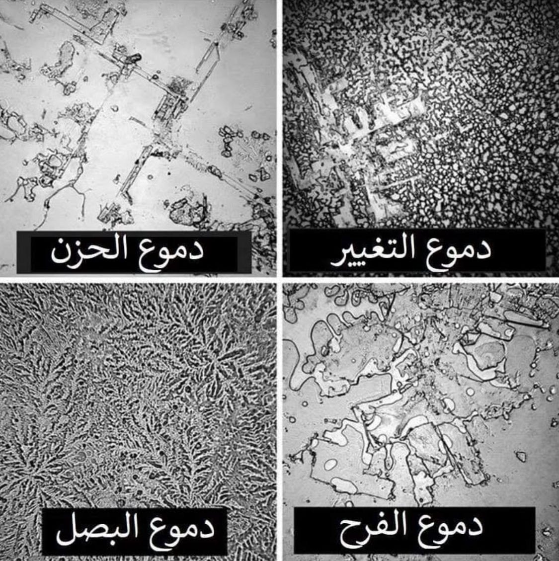 #الدموع
عرفتُ مؤخرًا معلومةً تخصّ الدموع، وشعرتُ بوجوب مشاركتِها هنا، وبعد بحثٍ بسيط، اكتشفتُ أنَّ تراكيب الدموع تختلف باختلاف السبب الذي ذُرفت لأجله، حيث إنّ هناك دموعًا قاعدية، انعكاسية، وعاطفية، وكلٌّ من هذه الأنواع يحتوي على تركيبة تُميّزه عن الآخر،
إذ إنَّ الدموع القاعدية