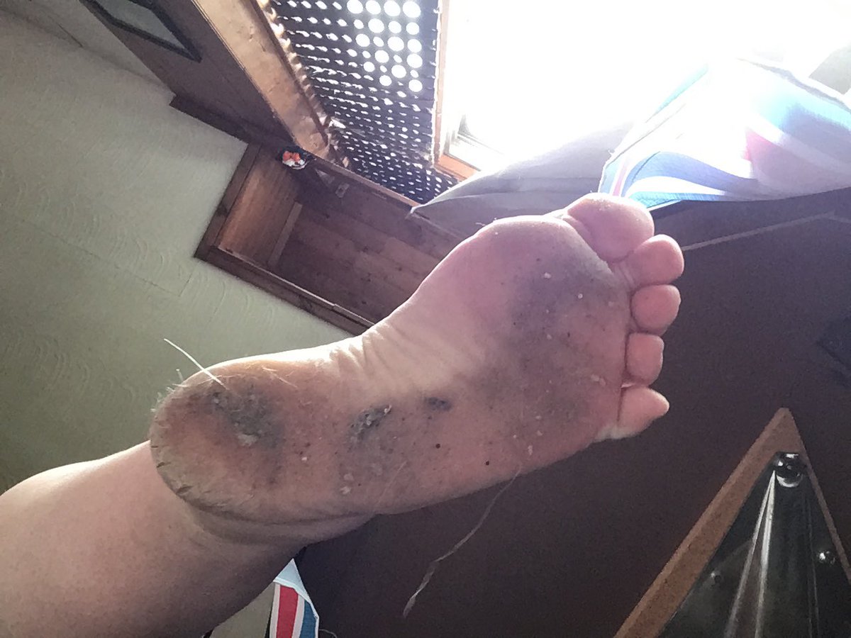 Let’s see who can cheer me up. 

Send me $20 and you will get a reward!!! 

Findom domme finsub subfunded femdom walletdrain walletslave moneyslave cashcow paypig piggy humanAtm humiliation homewreck blackmail sissy ABDL