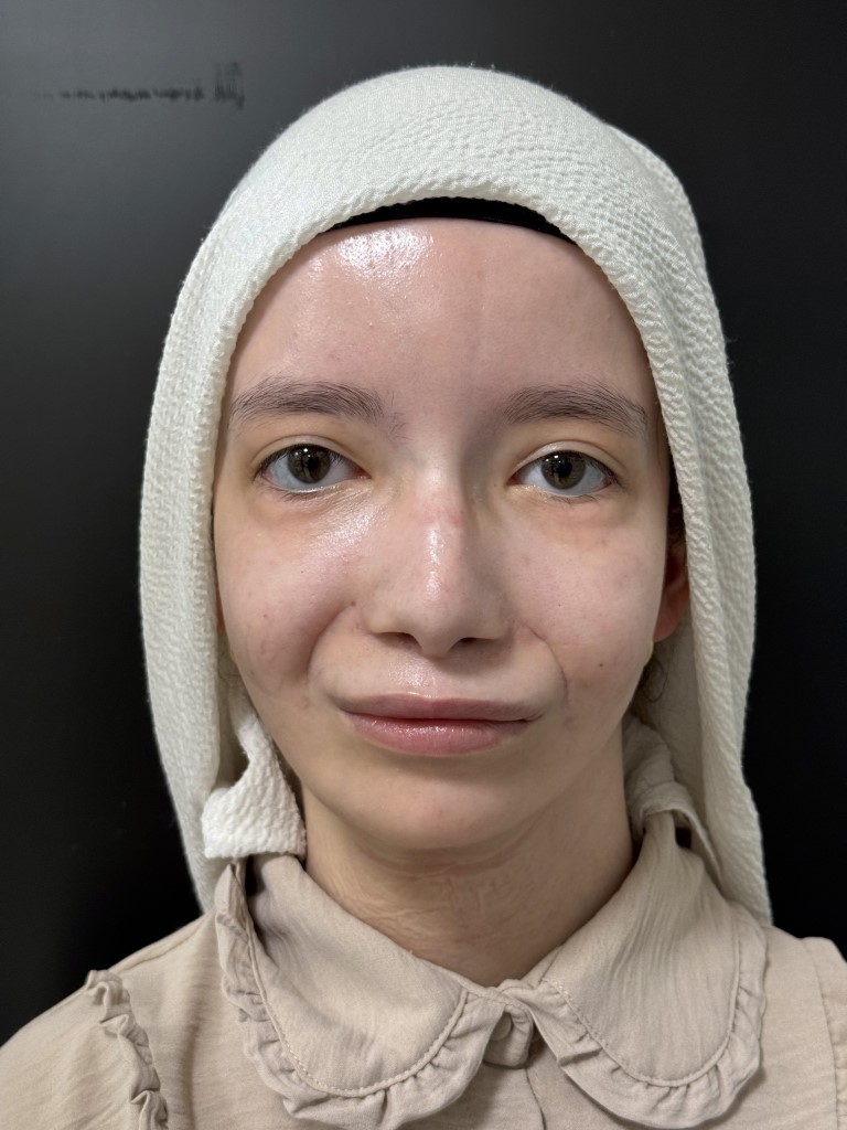 ihacomtr's tweet photo. Doğuştan mimiklerini kullanamıyordu, 23 yıl sonra ilk kez gülümsedi: "Ülkemizde bir ilk olma özelliği taşıyor"

https://t.co/Jr9ReREogK https://t.co/JzyX0EcW8p