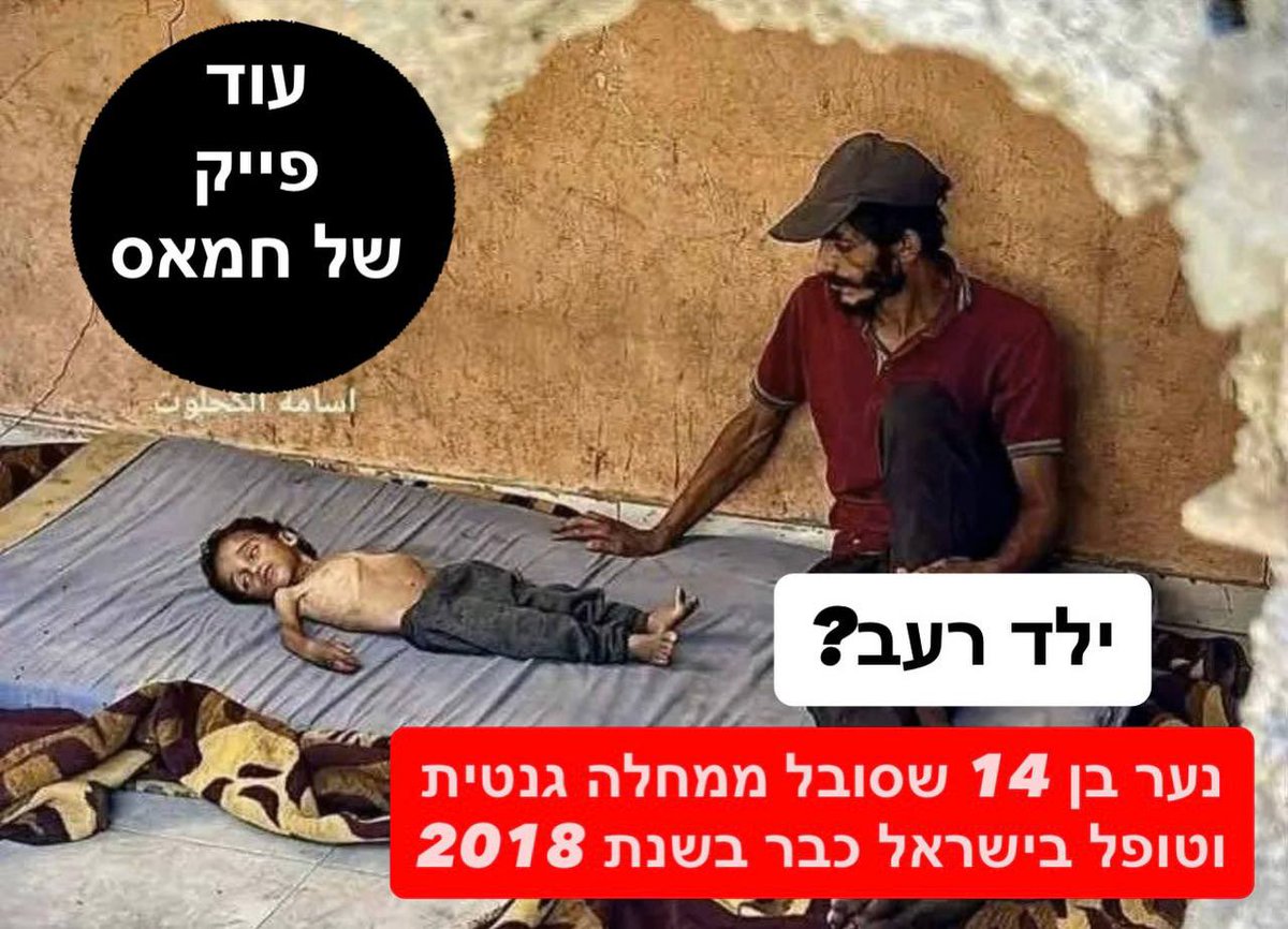 🇪🇸 Más mentiras de Hamás al descubierto: ¿Un niño hambriento?

Presten atención a esto: El niño Abdul Qader al-Tz, que "se muere de hambre en Gaza", padece una enfermedad genética.

Sí, Gal Saara, esta vez también es una historia falsa de Hamás.

Abdul padece una enfermedad