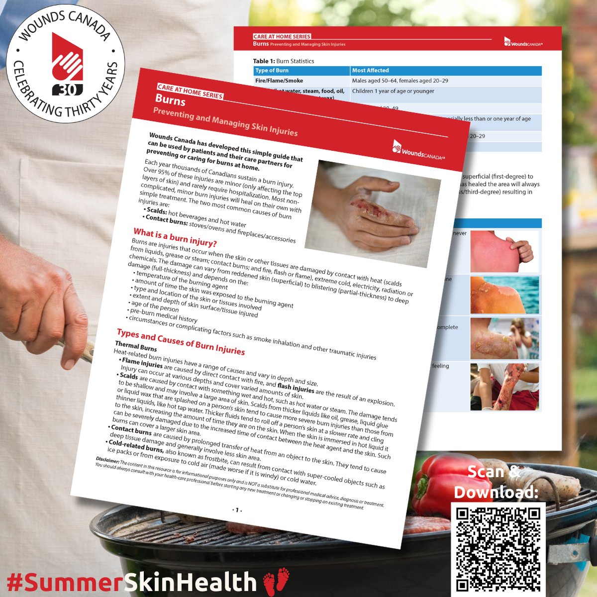 🔥 Outdoor fun comes with fire safety responsibilities!

Safe practices help prevent accidents and protect skin from burns. Learn more about preventing and managing burns here: ow.ly/RTEC50WwVL6