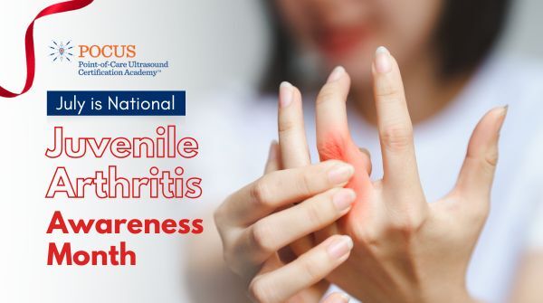 POCUSAcademy's tweet photo. July is #JAAwarenessMonth! Kids get arthritis too — early detection is crucial. Clinicians: Boost your MSK ultrasound skills with our Upper Extremity POCUS Certification. Learn more: https://t.co/R6W3Xd3y5O & Get certified today here 🔗 https://t.co/jclstyHdlX
#MSKPOCUS https://t.co/PXlF5v4UXN