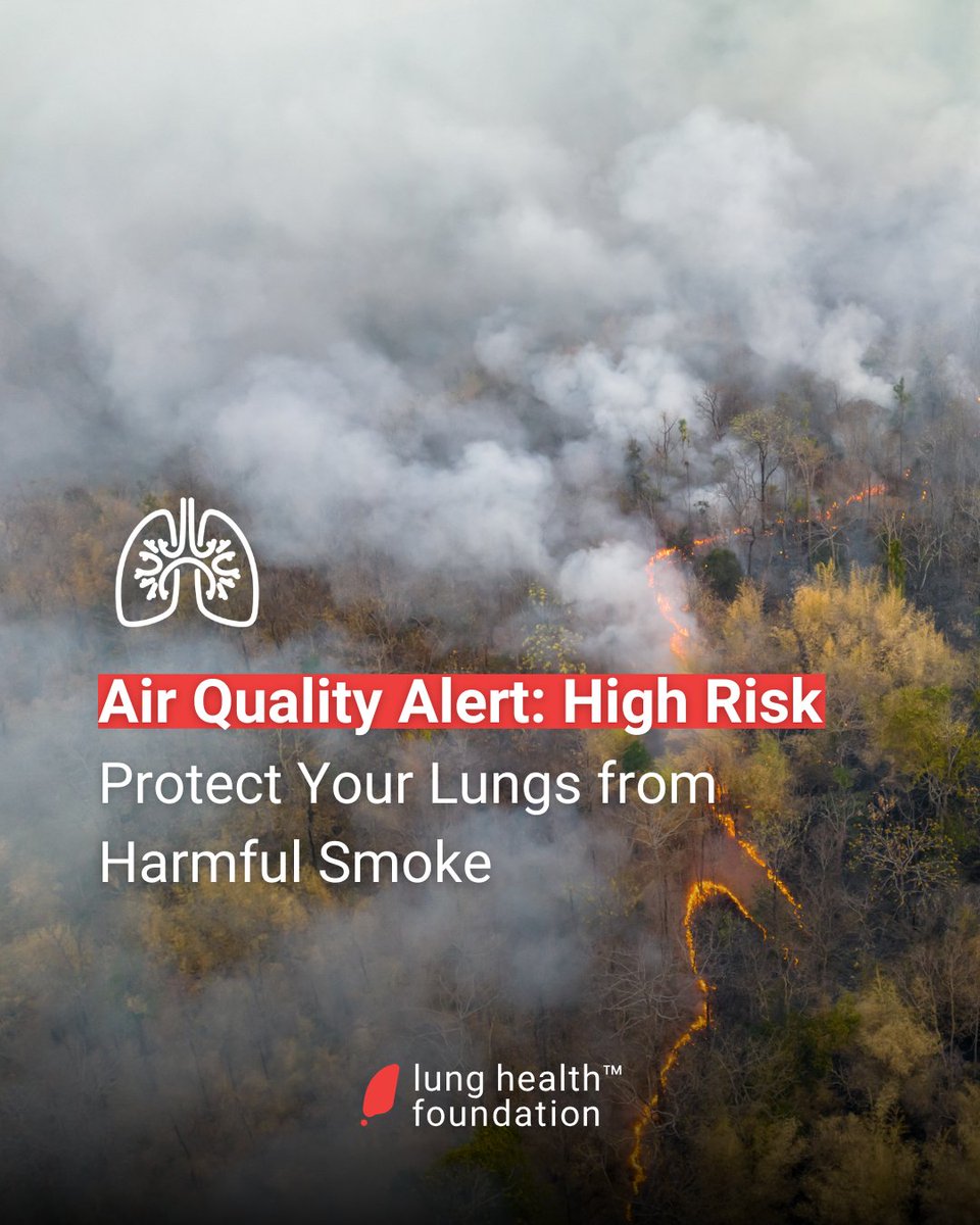 Wildfire smoke from the Prairies is impacting much of Central and Southern Ontario, with the Air Quality Health Index (AQHI) currently at high risk. Those with lung conditions, children, and older adults may be sensitive to smoky air. Learn more: bit.ly/3U6fWCk