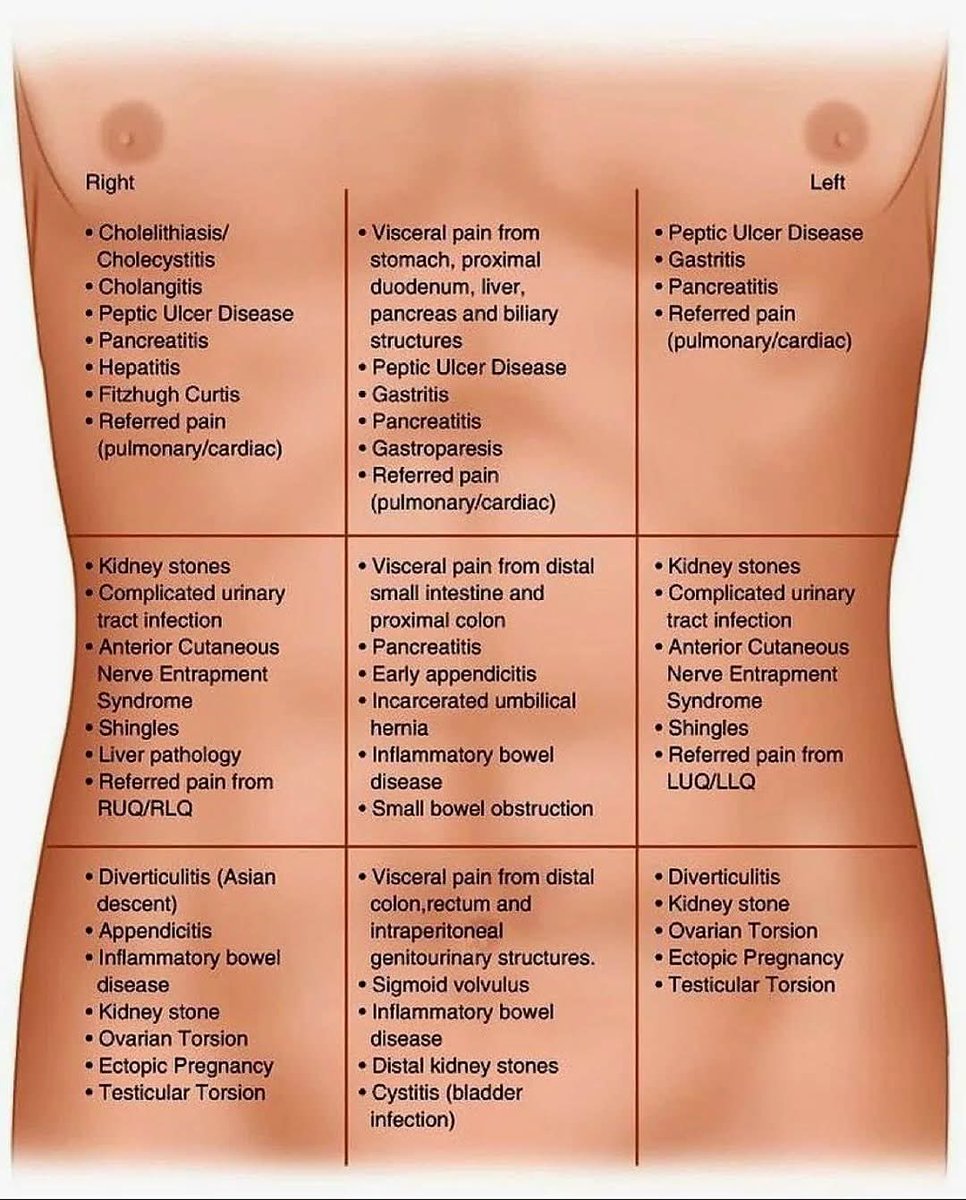 Causes of #abdominal_pain by site 📍