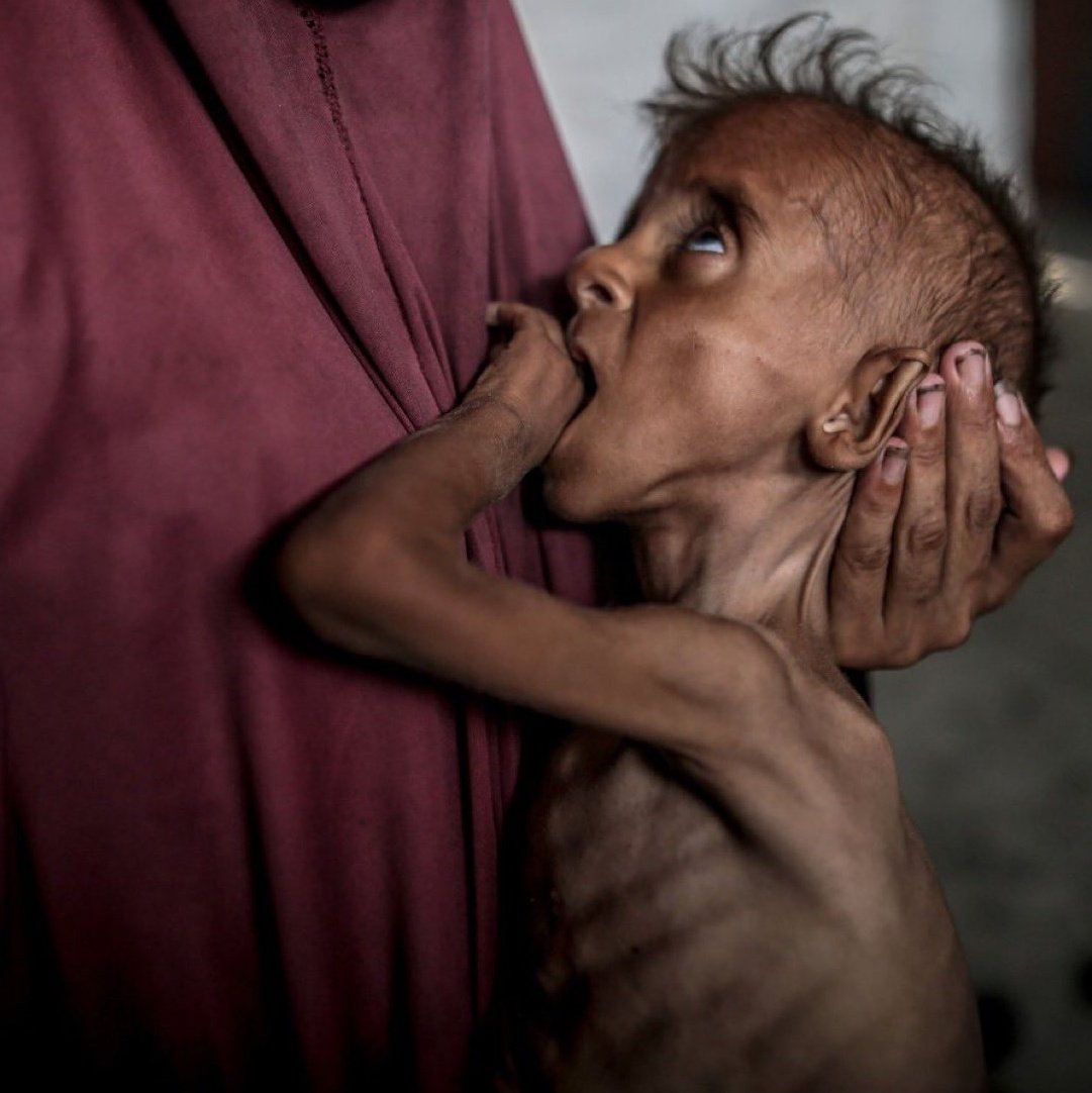 I am so hungry 🇵🇸💔