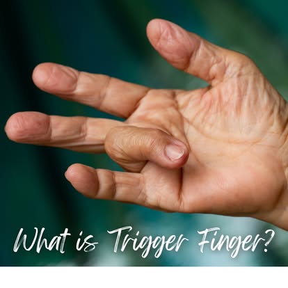 CaliberPain's tweet photo. You might have #triggerfinger if you experience:
Popping, pain, stiffness, a lump, or your finger gets stuck in a bent posititon. 

Learn more at: https://t.co/FzBjp1pE2s. https://t.co/4n9FWD3C3R