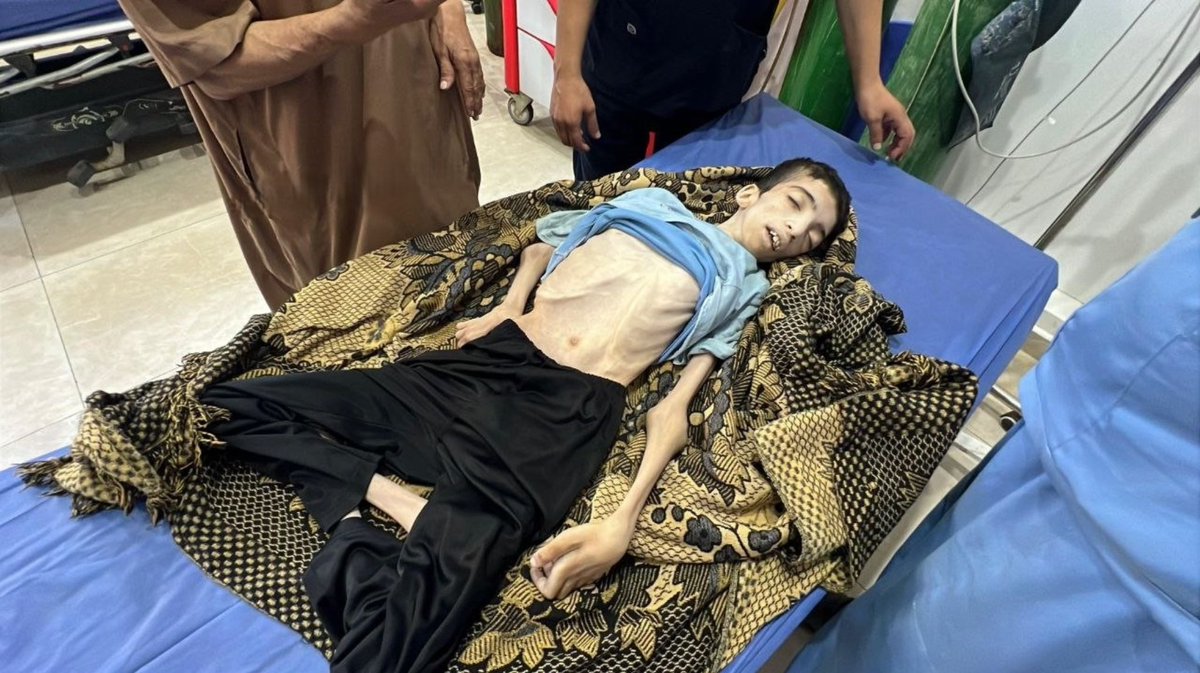 استشهاد طفل فلسطيني جراء المجاعة في غزة بعد منع الاحتلال من دخول الطعام 💔