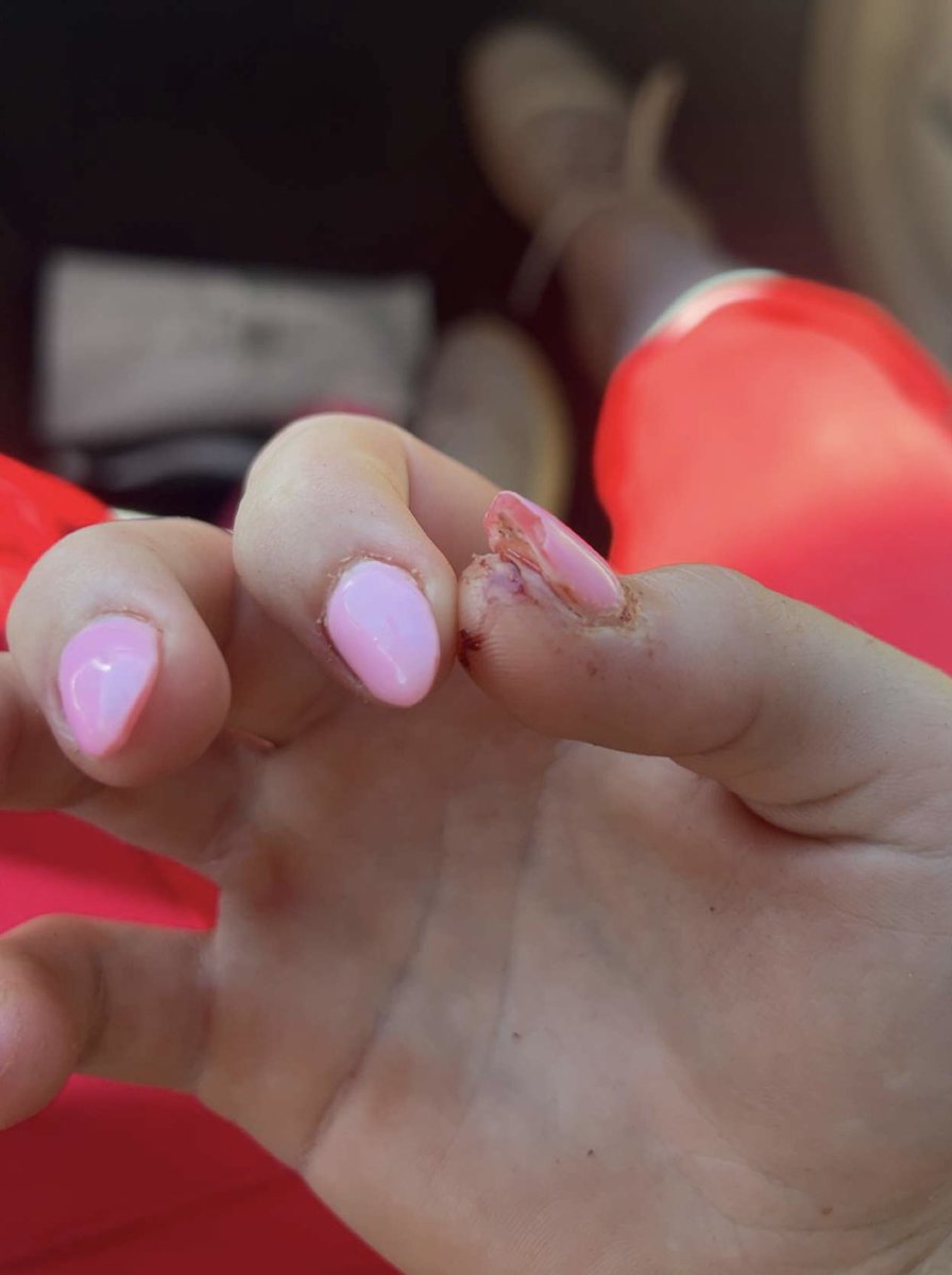SBRRetweets's tweet photo. Check this out! PeanutSchmitz99: Two day camp @TroyTrojansSB with a broken nail (which was removed yesterday). Back at the gym this morning! #NeverStopWorkin @los_stuff @LineDsoftball @ExtraInningSB @SBRRetweets @IHartFastpitch @scan1ansports @QrRecruiter https://t.co/5aROR2U4cB