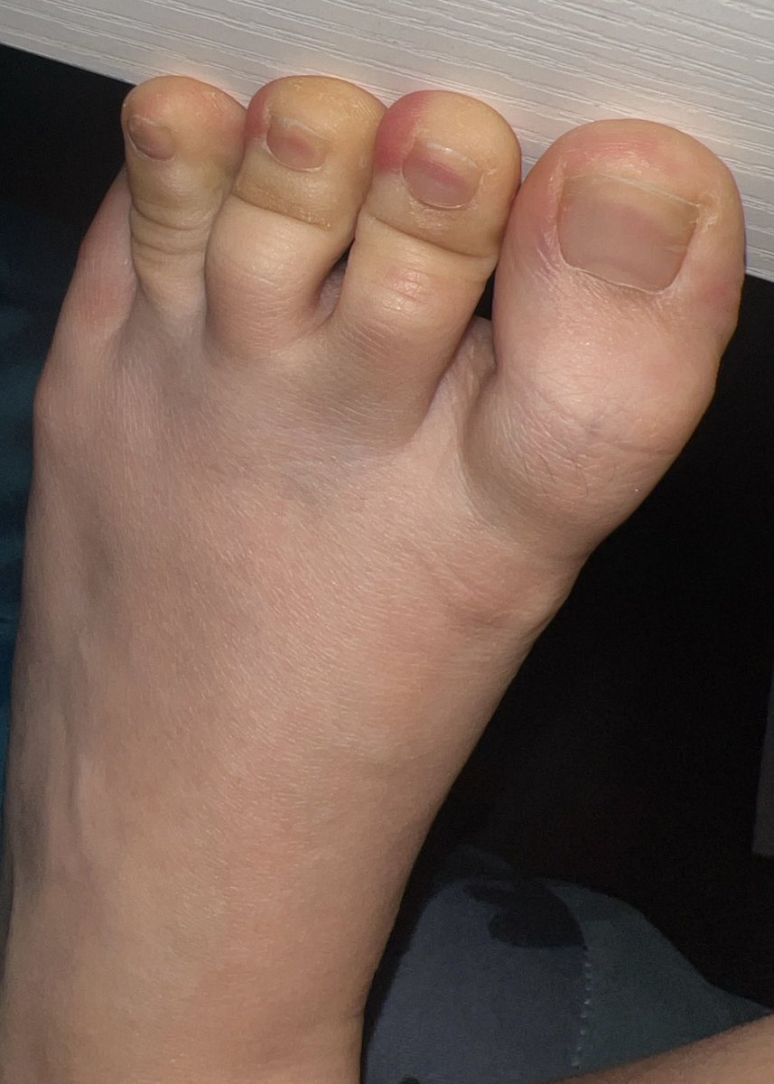 Jacy Siren Feet tweet media