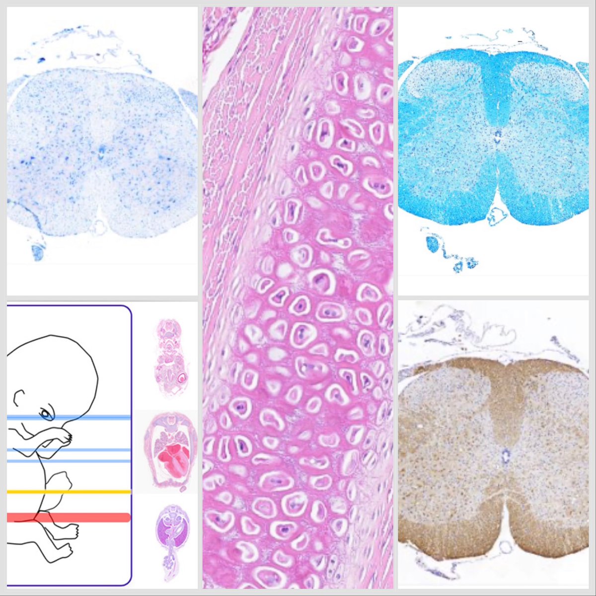 Y en estos días subimos varios preparados nuevos! 

93-pene - he
47-microglía - drh
101-trompa de falopio he 6
27-cartílago elástico - he
113 - piel fina he 2 
prep. problema (neuro): pn2a, pn2b, pn2c, Pn3

microscopiovirtual.fmed.edu.uy/index.html