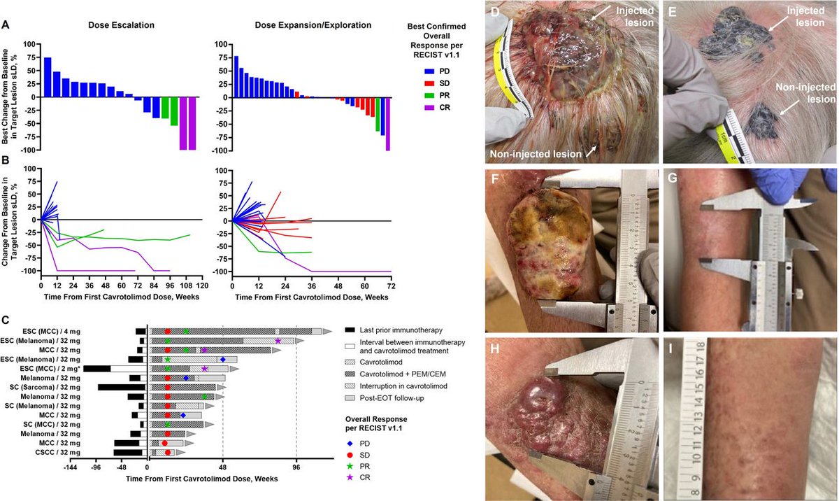 New #JITC article: Phase 1b/2 study evaluating safety, efficacy and immune effects of TLR9 agonist cavrotolimod with anti-PD-1 antibodies among patients with advanced solid tumors bit.ly/4o7JmOp <a href="/DouglasELaux/">Douglas E. Laux</a> <a href="/ad1600/">Adil Daud</a> <a href="/MKWongMDPhD/">Michael K Wong MD</a>