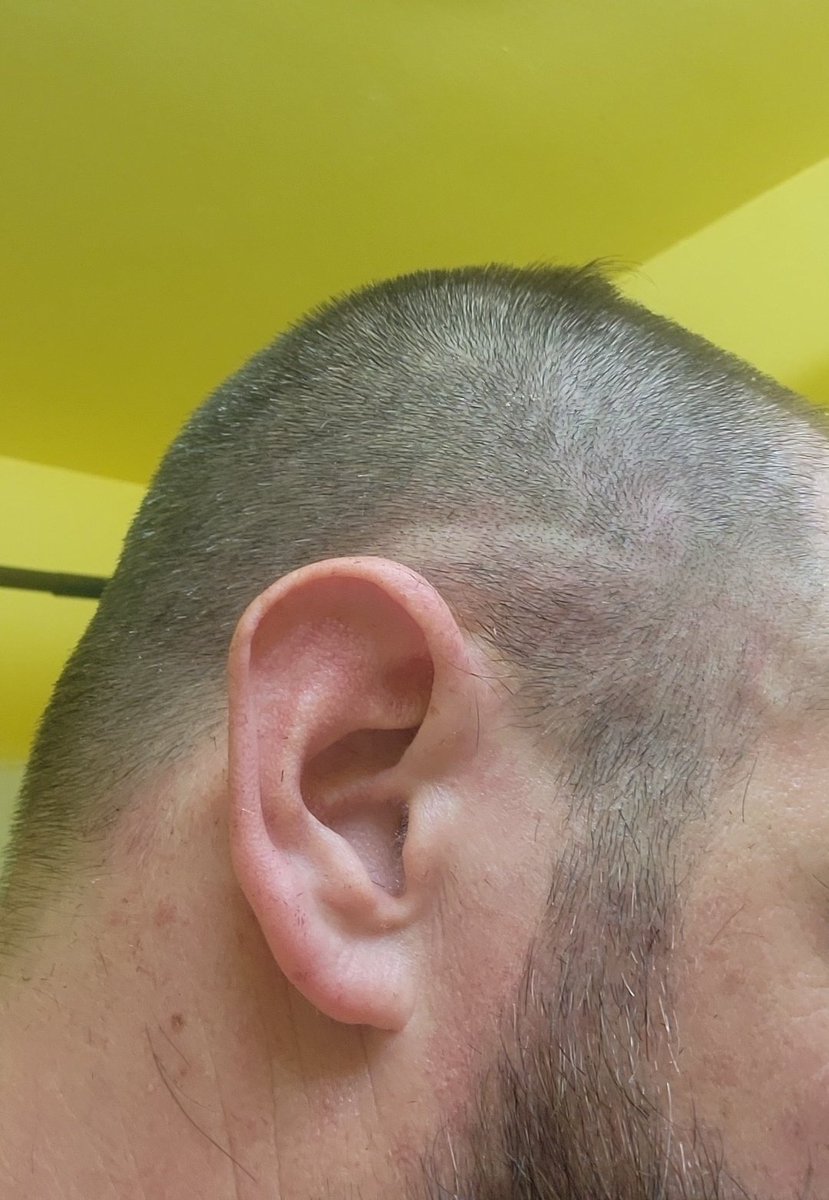 How is that even possible? Guess I'm shaving it.