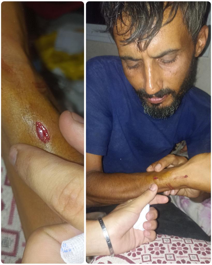 I'm not ashamed to say that‼️
I am hungry. I went to the aid distribution center to get flour and returned to the tent injured.
We need your donations and support so that we can meet the needs of our children.
Share this please and donate if you can 🙏 
gofund.me/ec58b05d