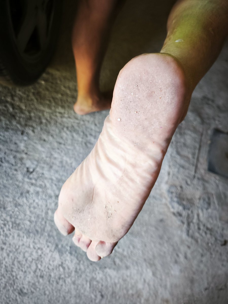 bla-bla-bill (@billnudism) on Twitter photo 