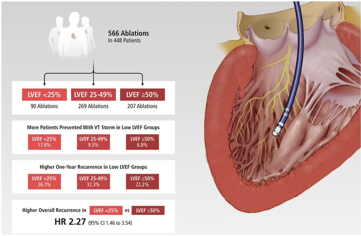 Outcomes following catheter ablation for structural ventricular tachycardia stratified by left ventricular ejection fraction: A retrospective cohort study, by <a href="/TheRhythmDoc/">Gurukripa Kowlgi, MD, MS</a> and colleagues
<a href="/MayoClinicCV/">Mayo Clinic CV</a> <a href="/MayoEPFellows/">Mayo Electrophysiology Fellowship</a> <a href="/MayoClinic/">Mayo Clinic</a> #EPeeps
heartrhythmopen.com/article/S2666-…